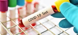 INFORMATIVA TEST SIEROLOGICI #COVID-19